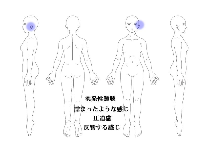 突発性難聴