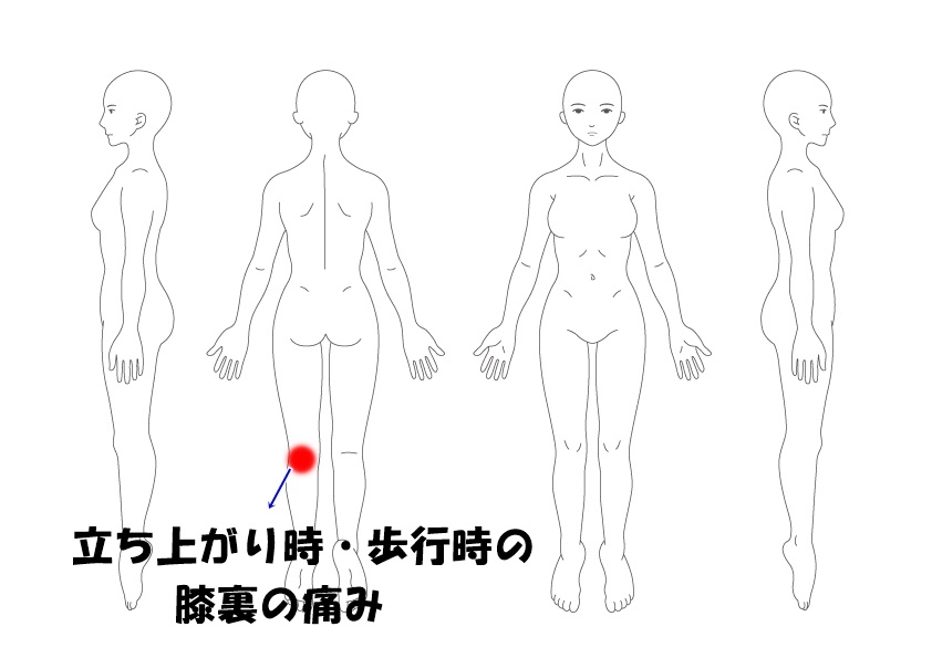 膝裏の痛み