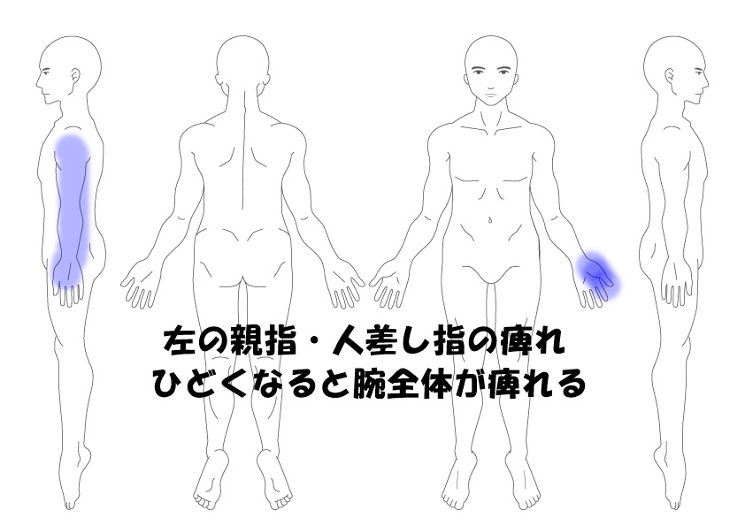 しびれ 症例 那覇市 沖縄の那覇にある當山鍼灸院が 腰や肩 背中の痛みを針治療で改善