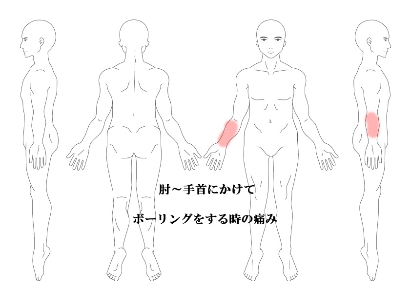 肘痛　手首痛