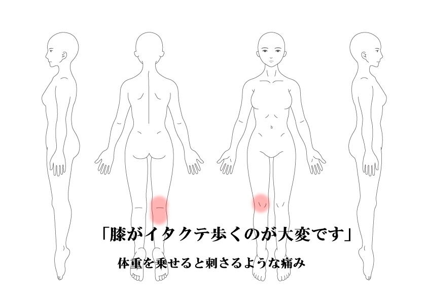 膝の痛み