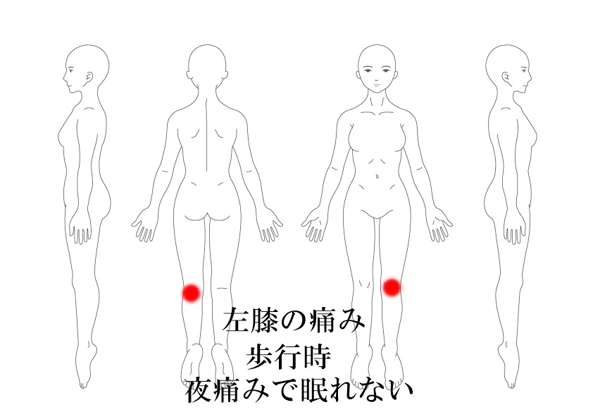 膝の痛み