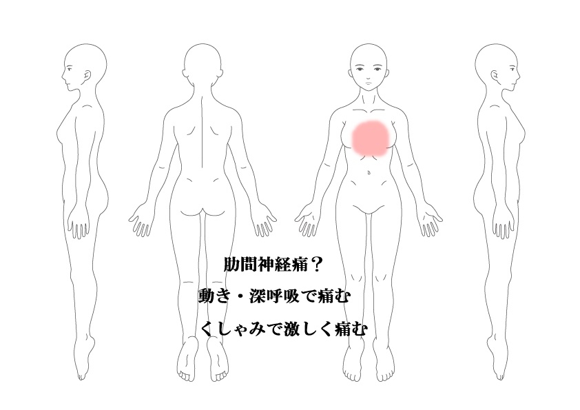 肋間神経痛