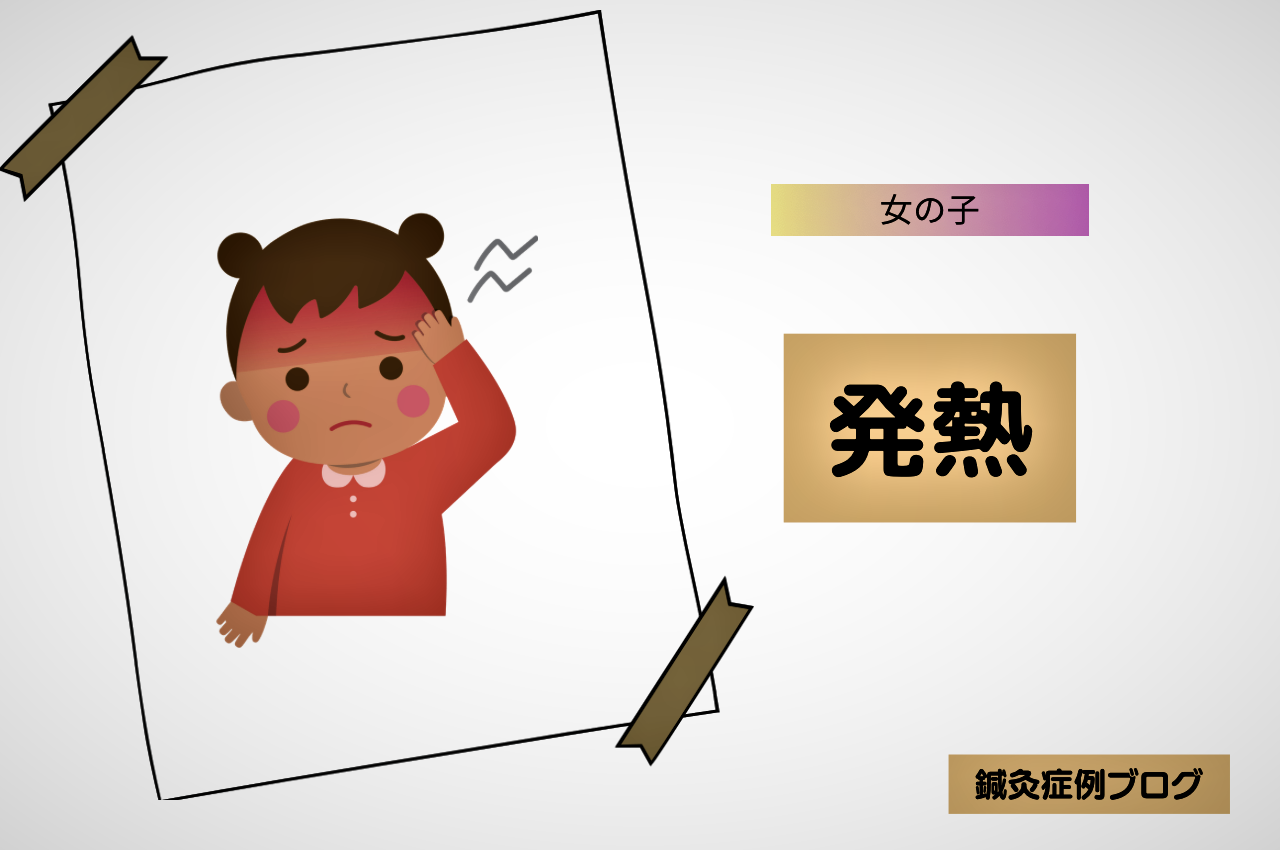 小児はり